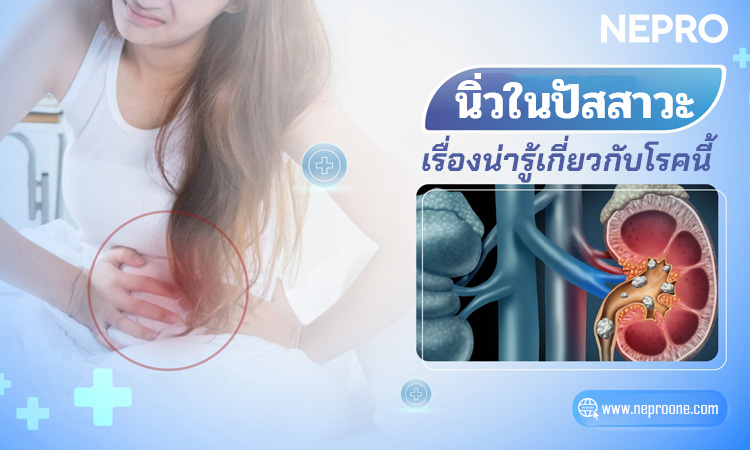 สิ่งที่ต้องรู้เกี่ยวกับนิ่วในไตในปัสสาวะ