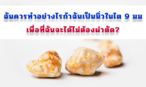 ฉันควรทําอย่างไรถ้าฉันเป็นนิ่วในไต 9 มม. เพื่อที่ฉันจะได้ไม่ต้องผ่าตัด?