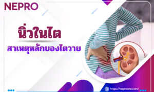 นิ่วในไต - สาเหตุหลักของไตวาย