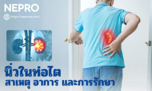 นิ่วในท่อไต: สาเหตุ อาการ และการรักษา