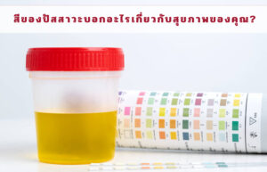 สีของปัสสาวะบอกอะไรเกี่ยวกับสุขภาพของคุณ?